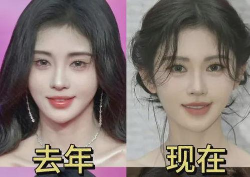 赵露思否认整容 明星大侦探第五季,明星大侦探第五季揭秘真相